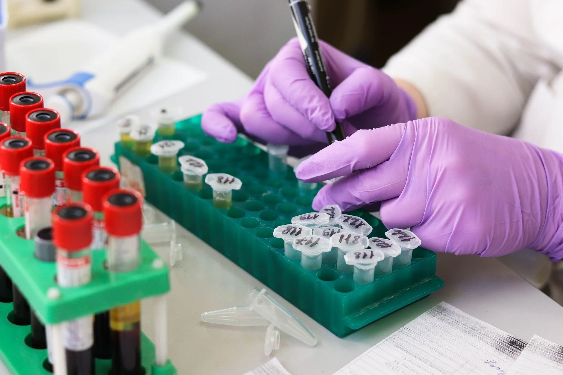 APHSS Meeting with L.A. County Health Official Confirms 9 Adult Performers May Have Tested Positive for Syphilis