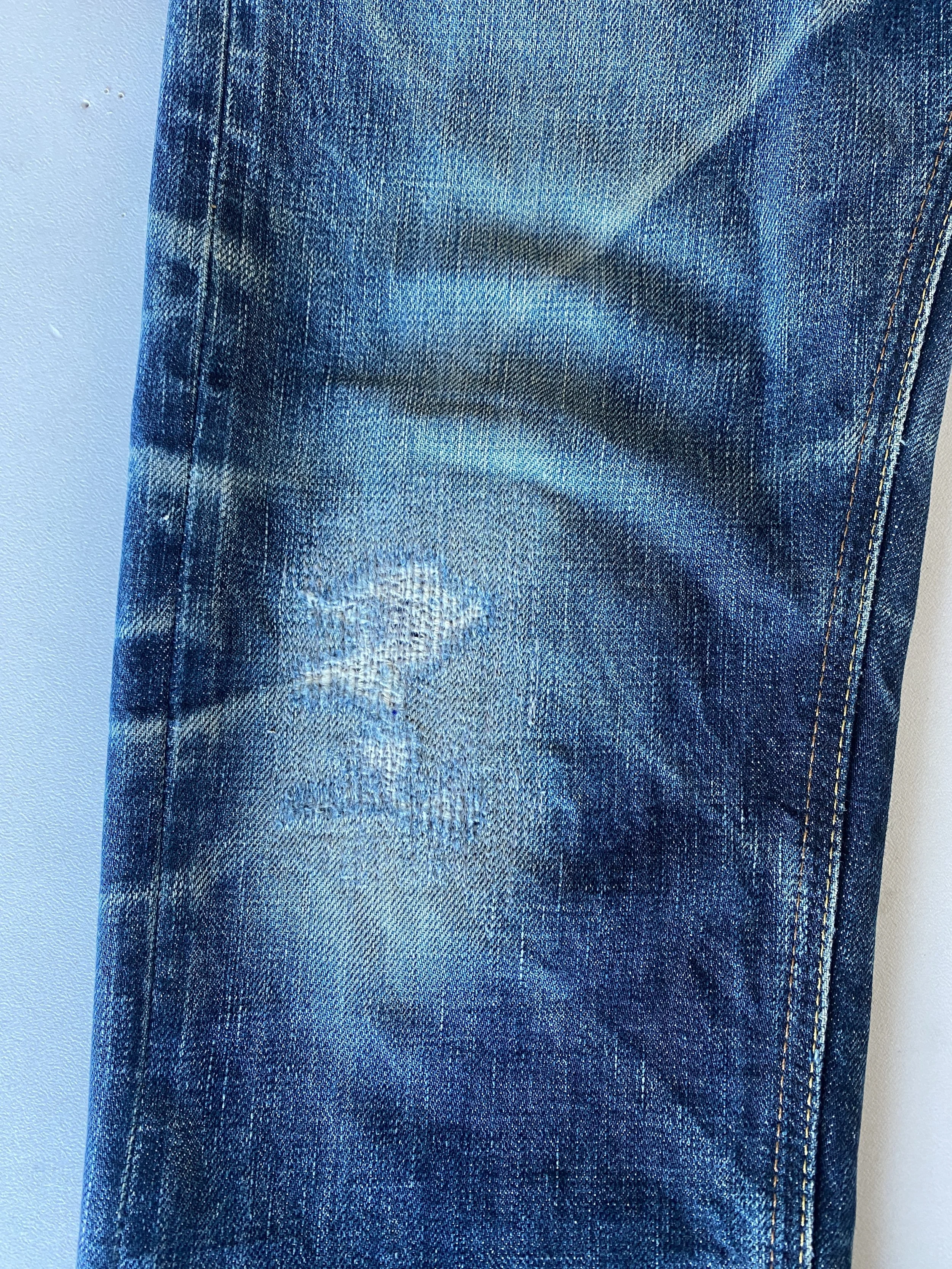 knee 4 repair after.JPG