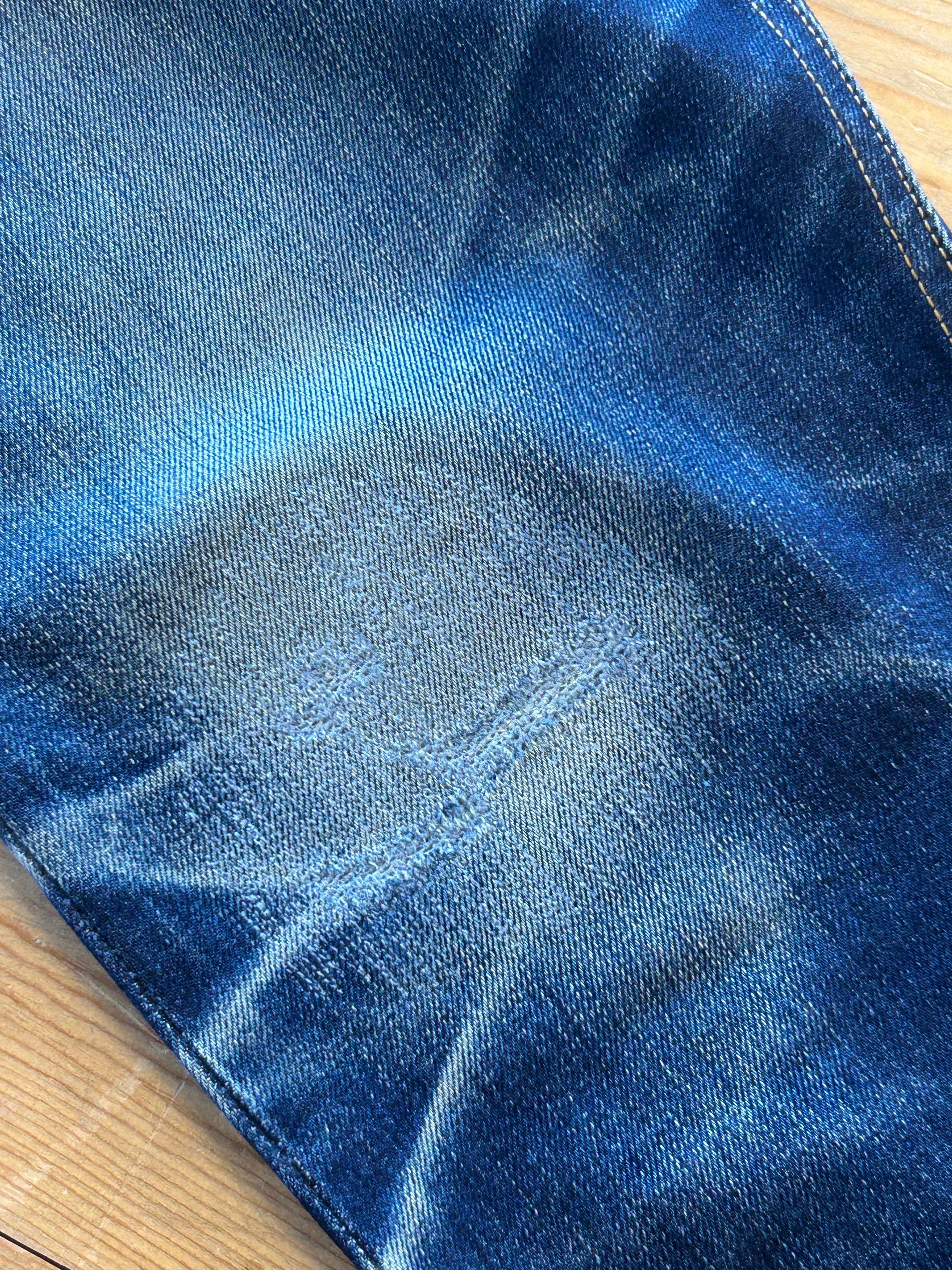 Knee 1 repair ______.JPG