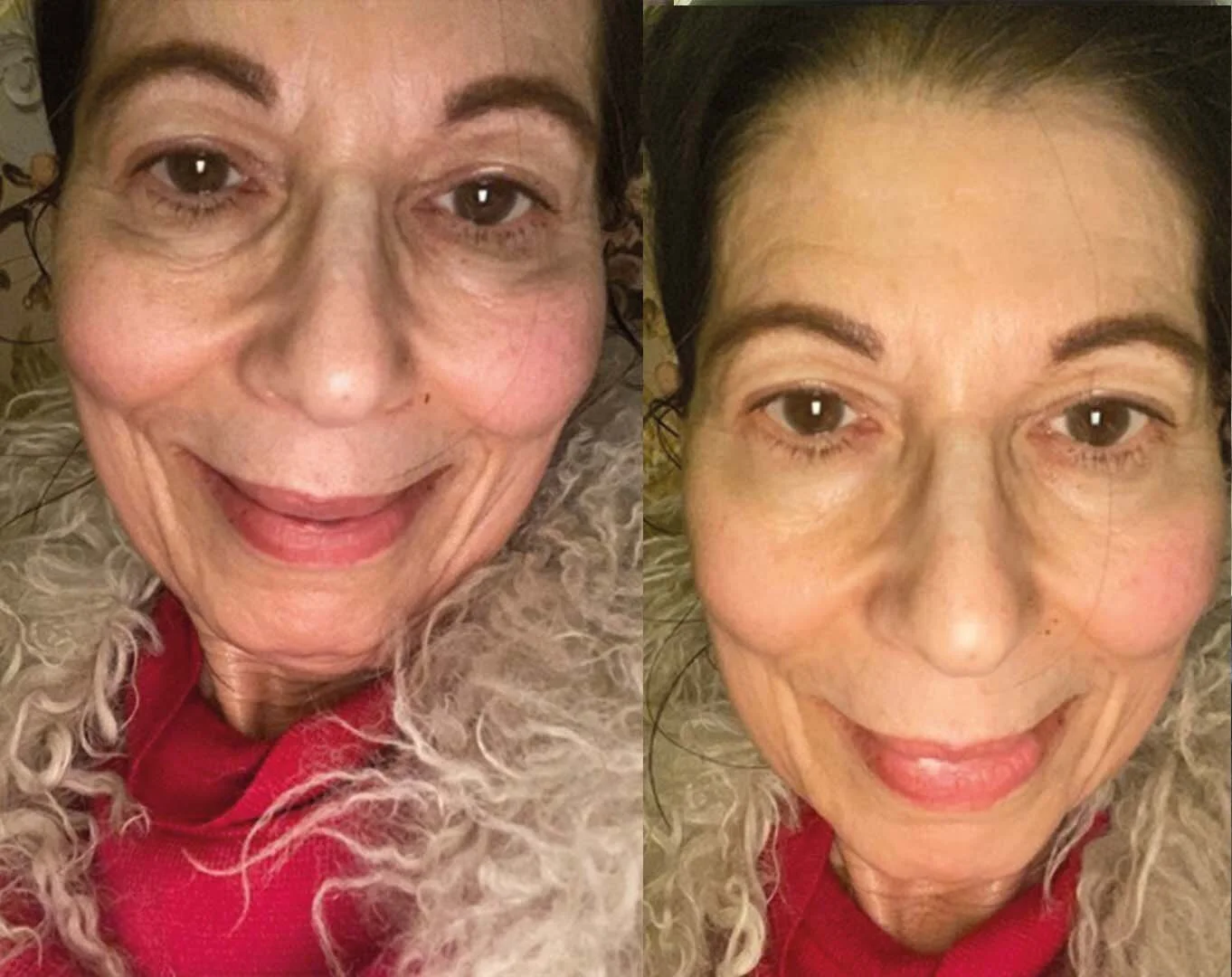 Top more than 70 malar bags causes latest in.duhocakina