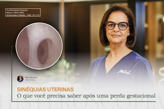 Sinéquias uterinas: O que você precisa saber após uma perda gestacional