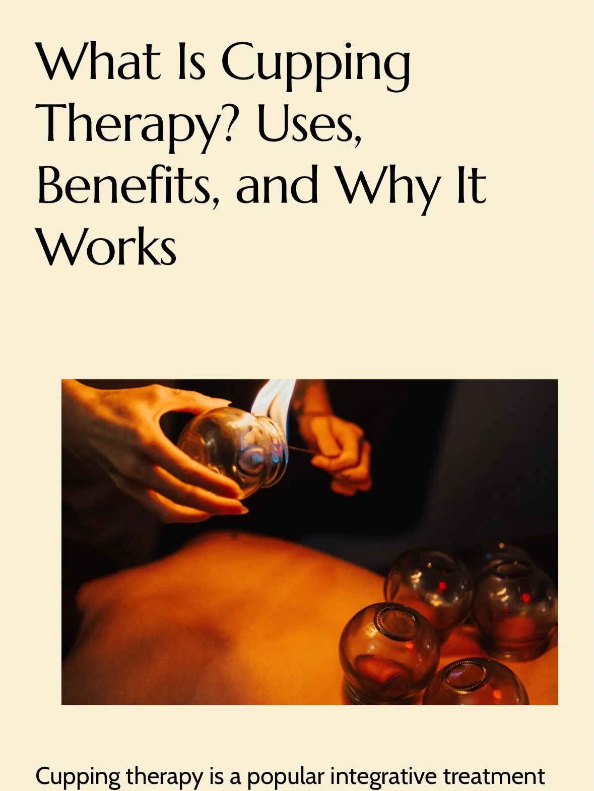 Fresh blog post now live! 💫 [Link in bio or it&rsquo;s in your email inbox if you&rsquo;ve subscribed]

Learn the ins and outs of #cuppingtherapy, what the #cupping marks mean, and the different types of cupping that are available.

At Nu Wave Acupu