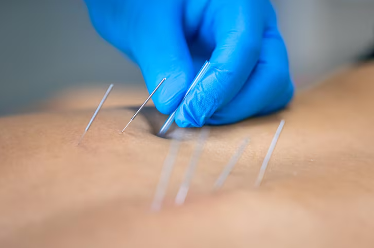 How Do Acupuncture and Massage Therapy Work Together for Pain Relief?