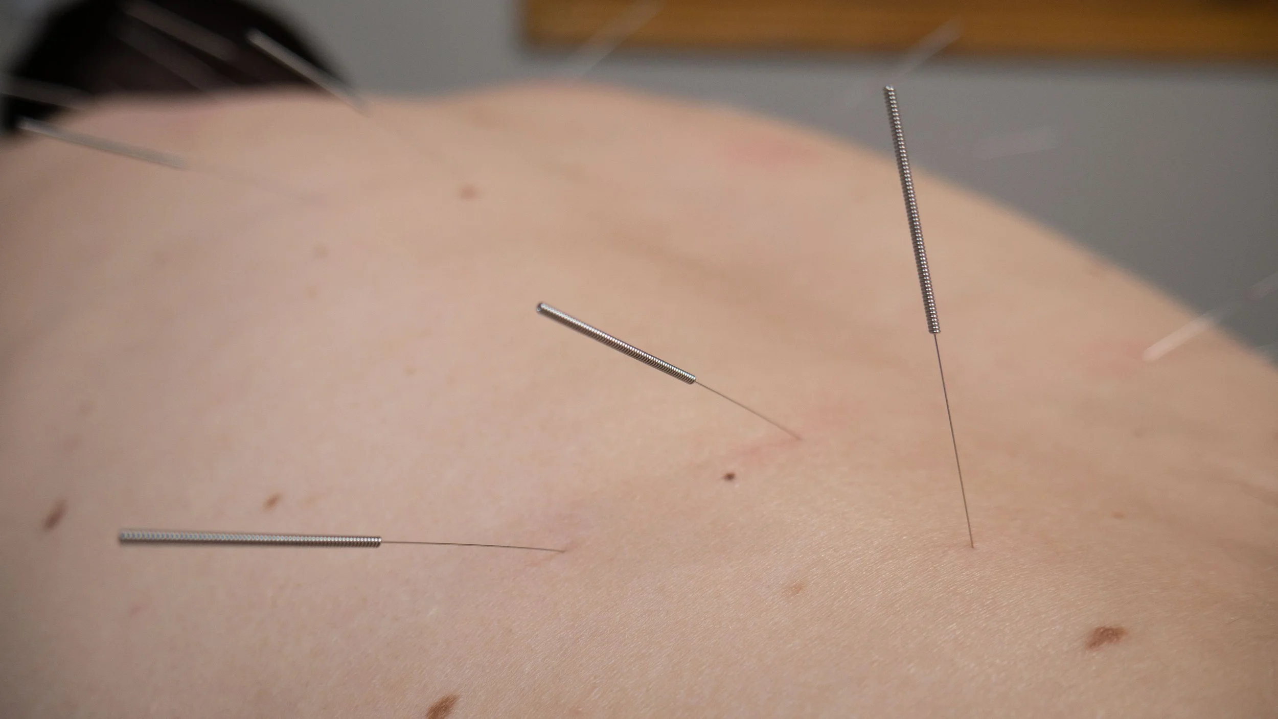 What Is Qi? Types of Qi According to Traditional Chinese Medicine