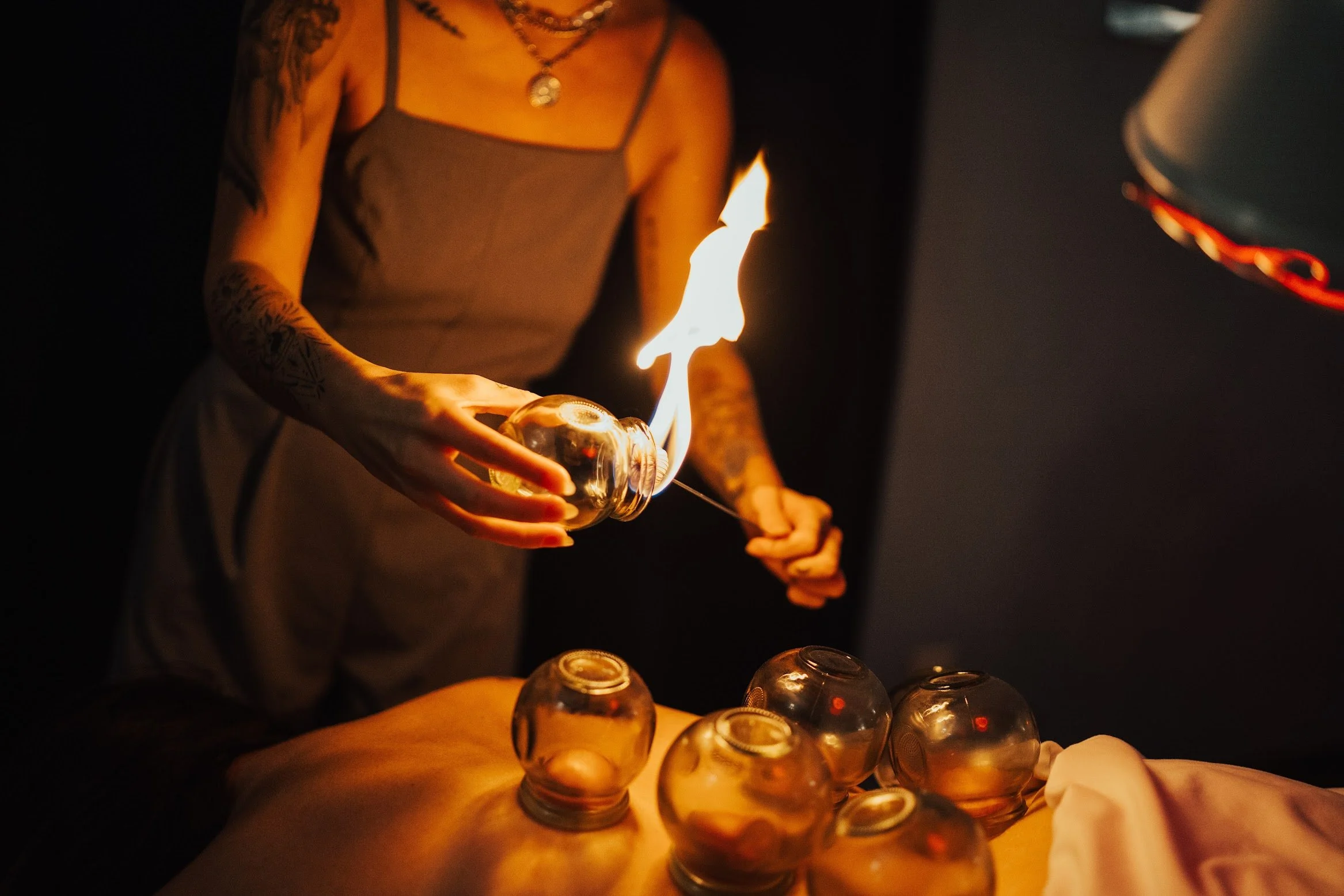 fire cupping therapy