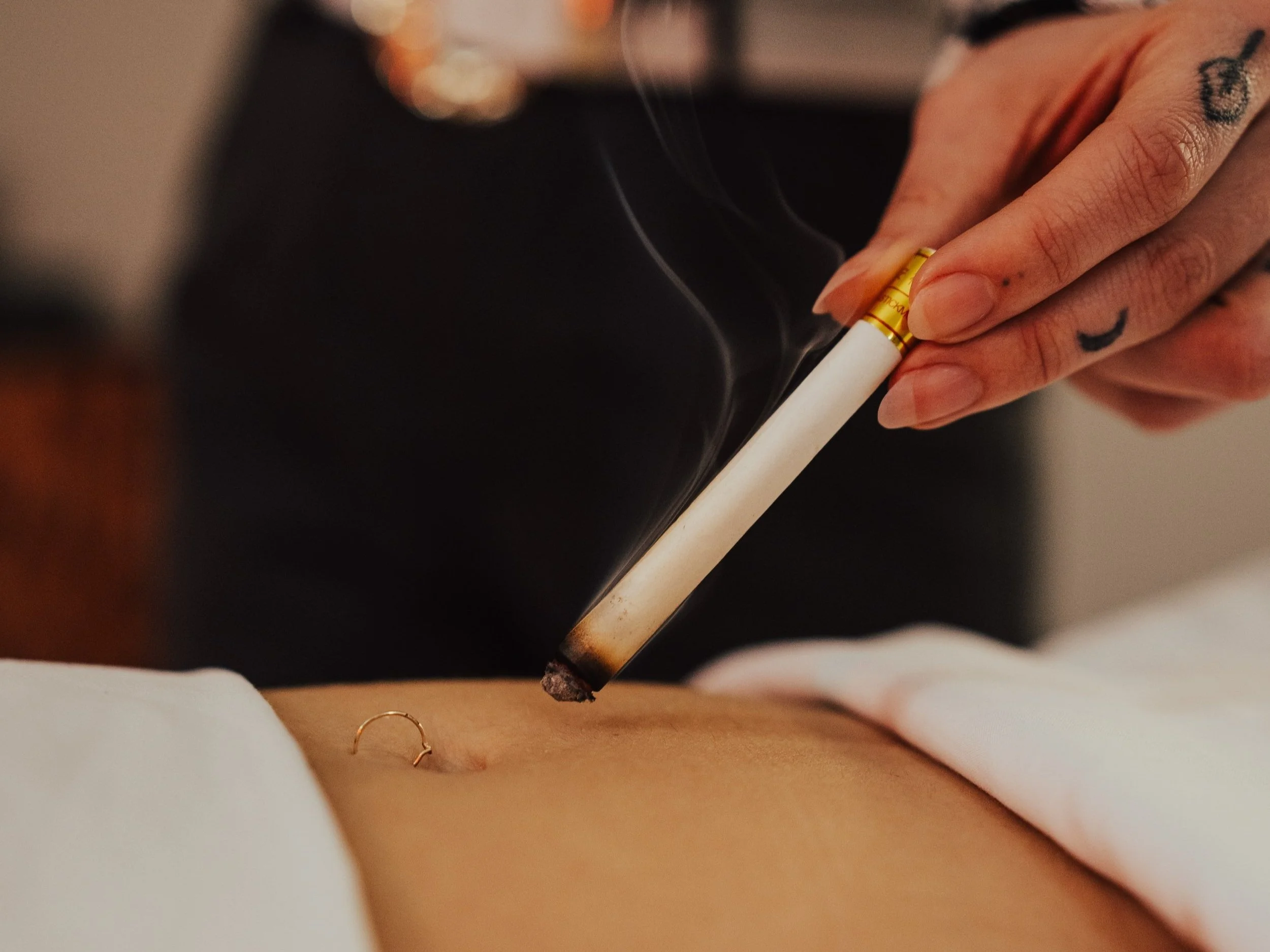 moxibustion
