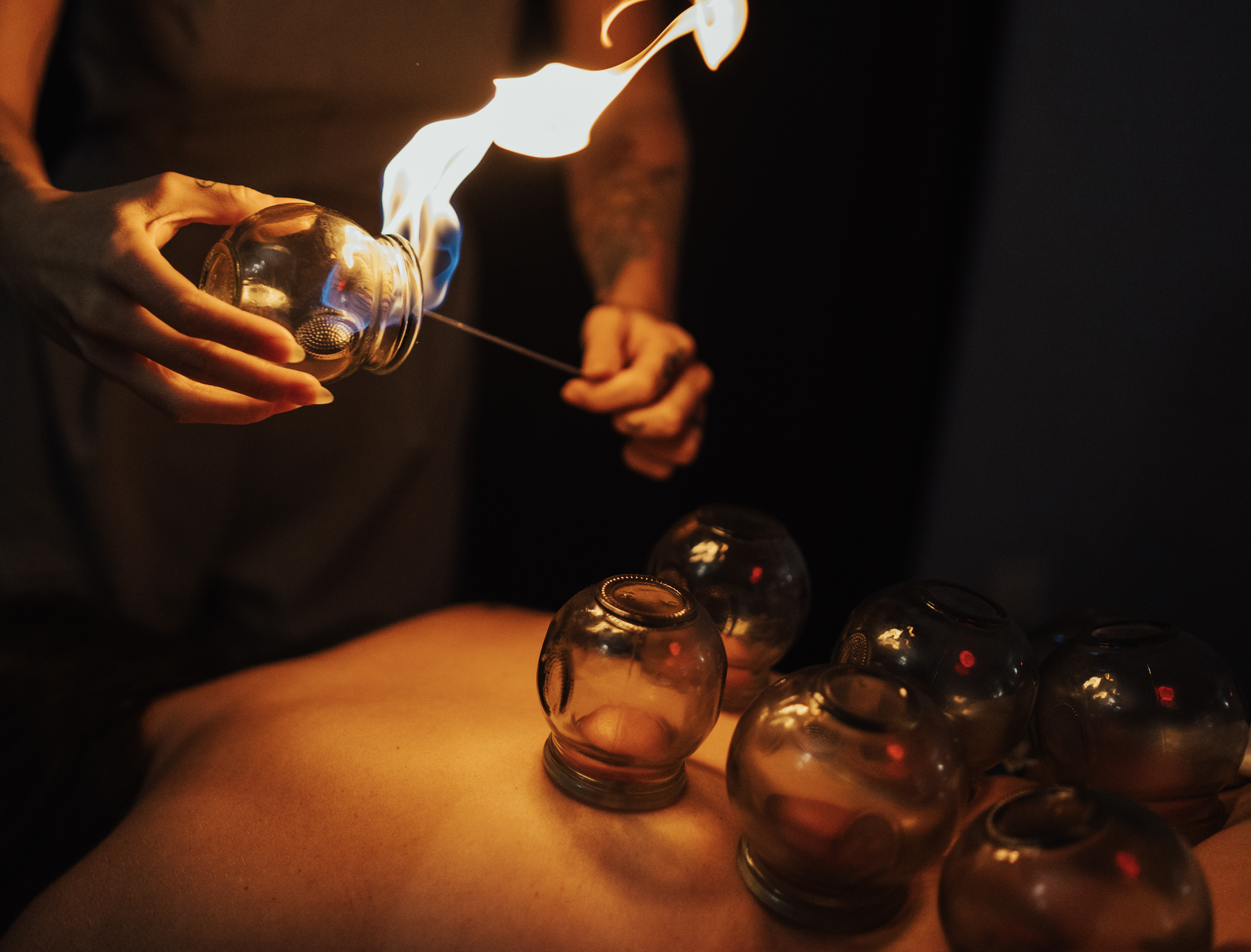 fire cupping columbus ohio