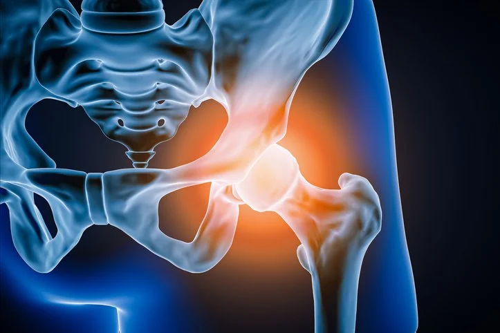 When Hip Pain Starts Changing the Way You Move