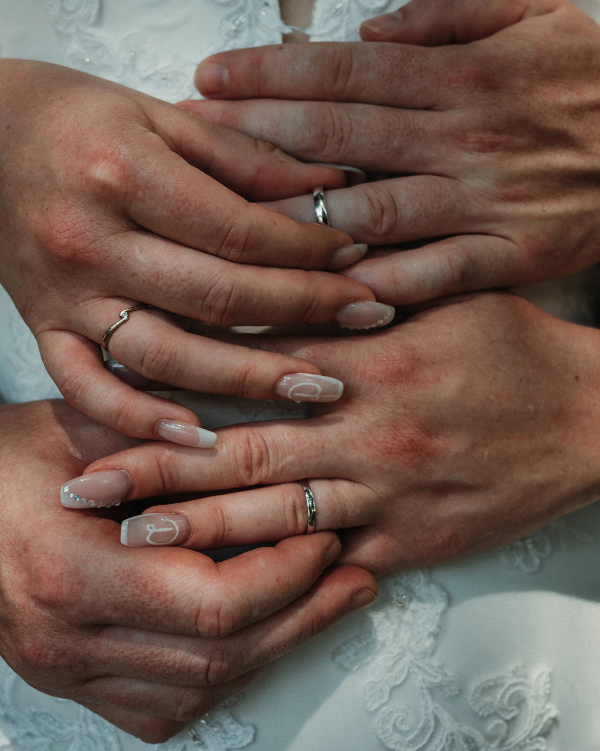 Close-up of two hands with wedding rings resting on lace fabric.