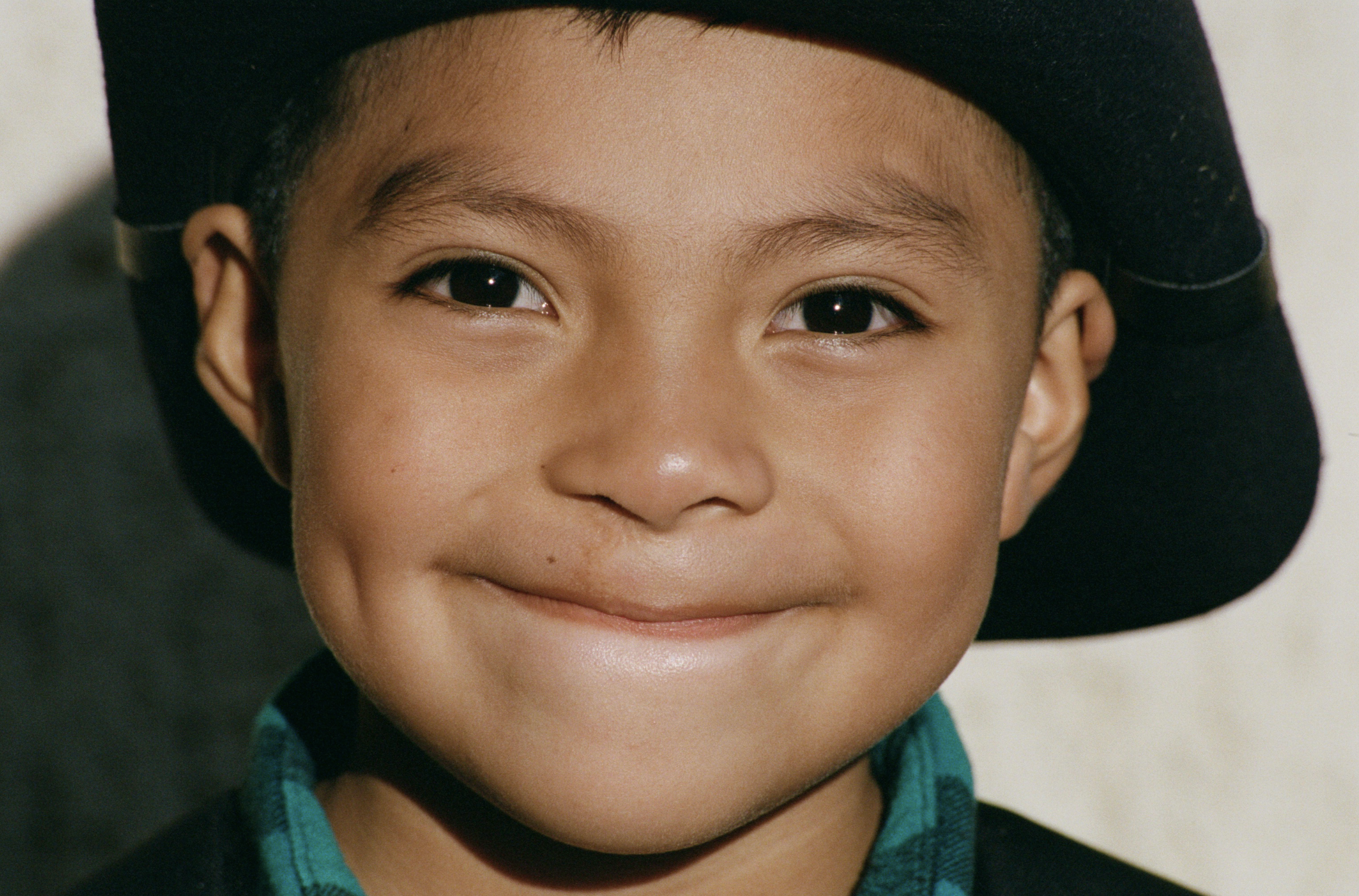 OPERATION SMILE