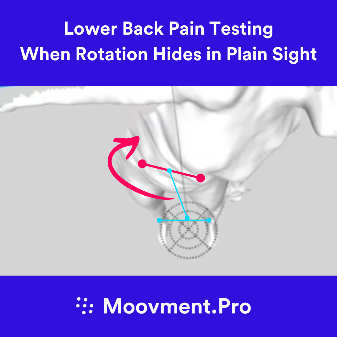 When Rotation Hides in Plain Sight: Why Overhead (Transverse-Plane) Views Matter for Low Back Pain