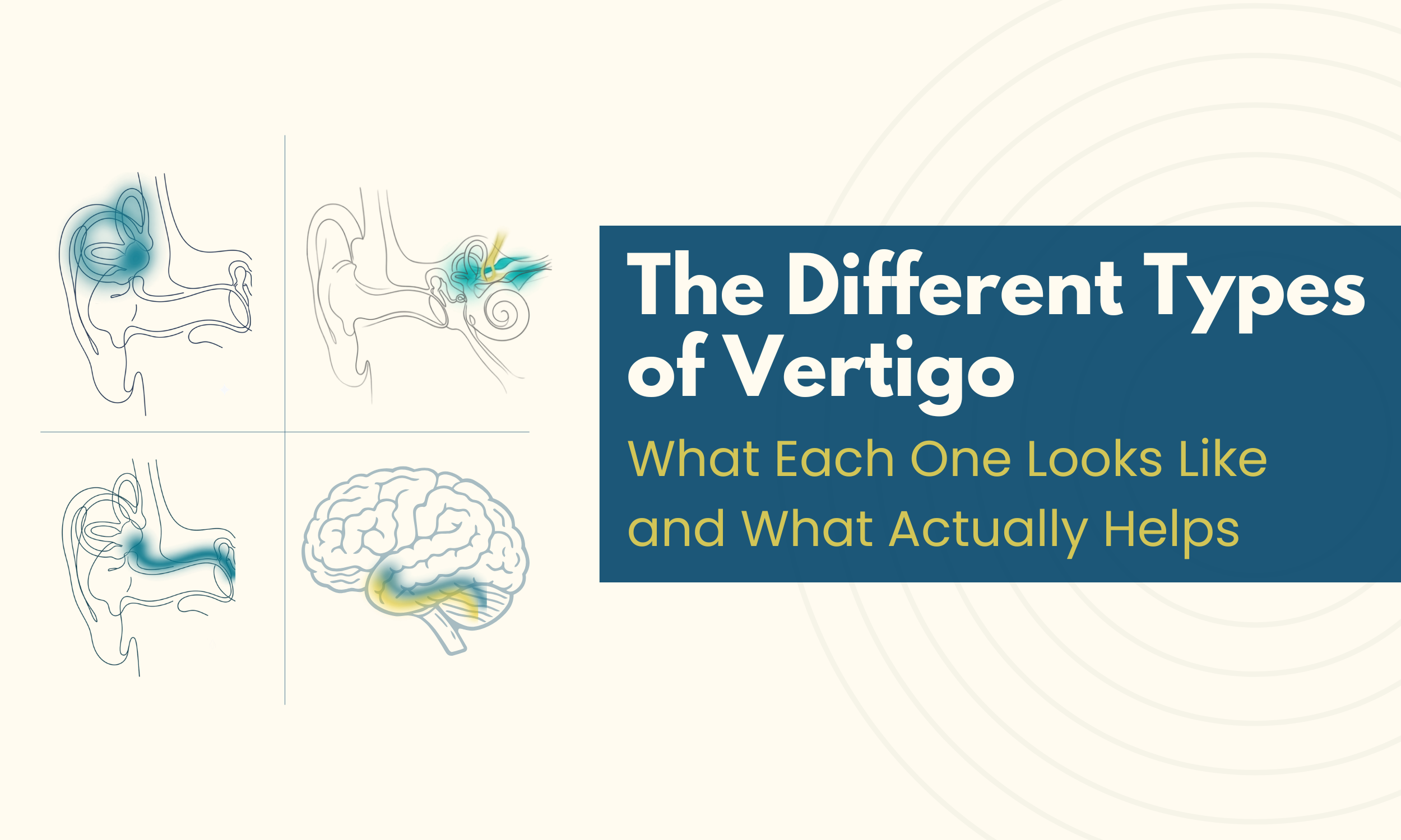 The Different Types of Vertigo, and What Each One Looks Like
