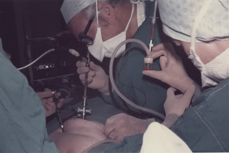 Patrick Steptoe performing a laparoscopic procedure during the clinical research at Oldham, c.1968 to 1978.