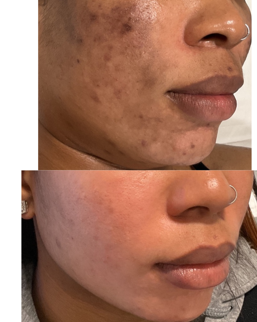 Simple Photocentric Before and After Instagram Story.png
