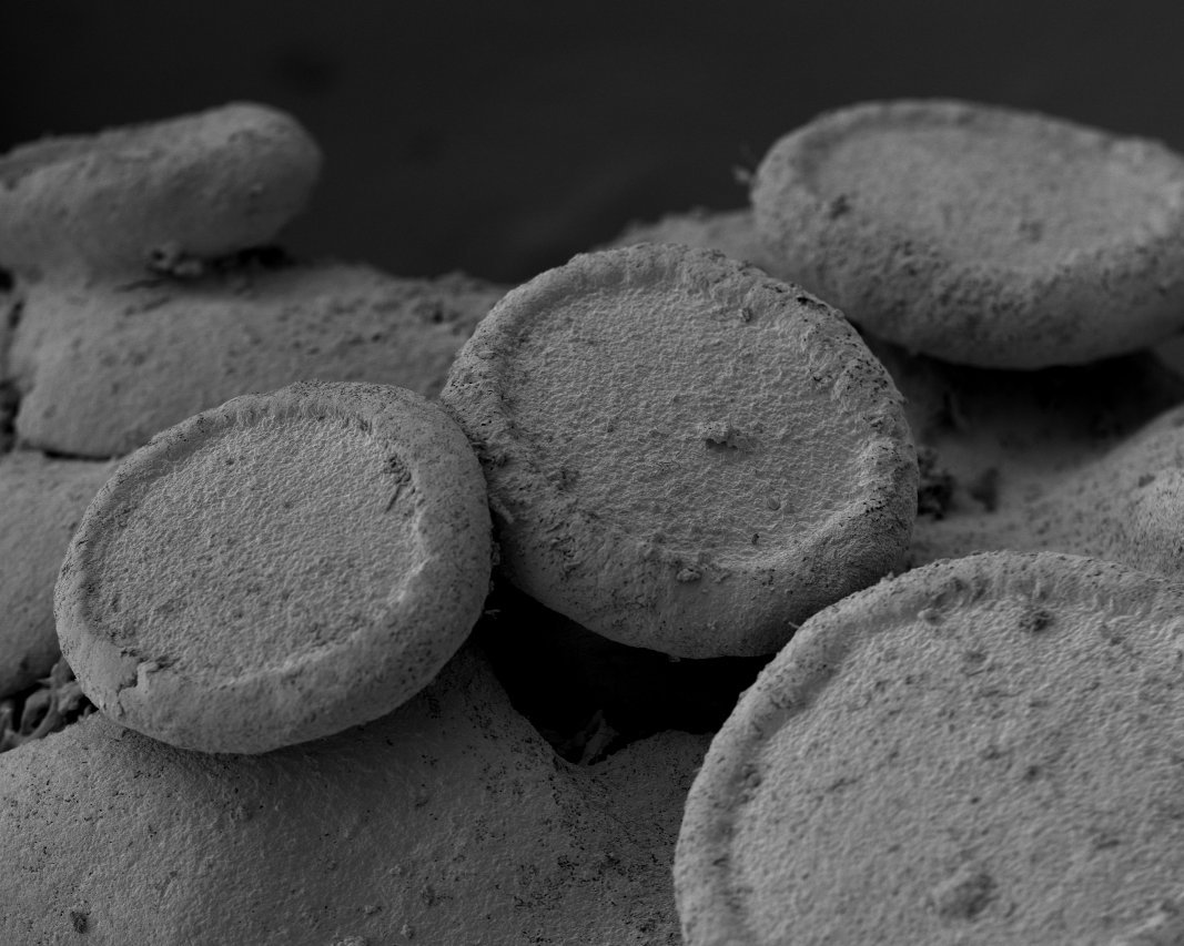   Lichen electron microscope photograph  