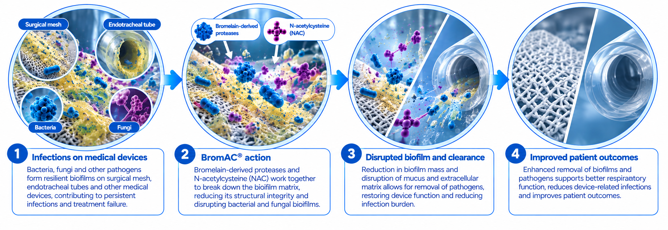 BromAc® biofilm disruption on surgical mesh and endotracheal tubes, showing bacterial and fungal biofilms being broken down