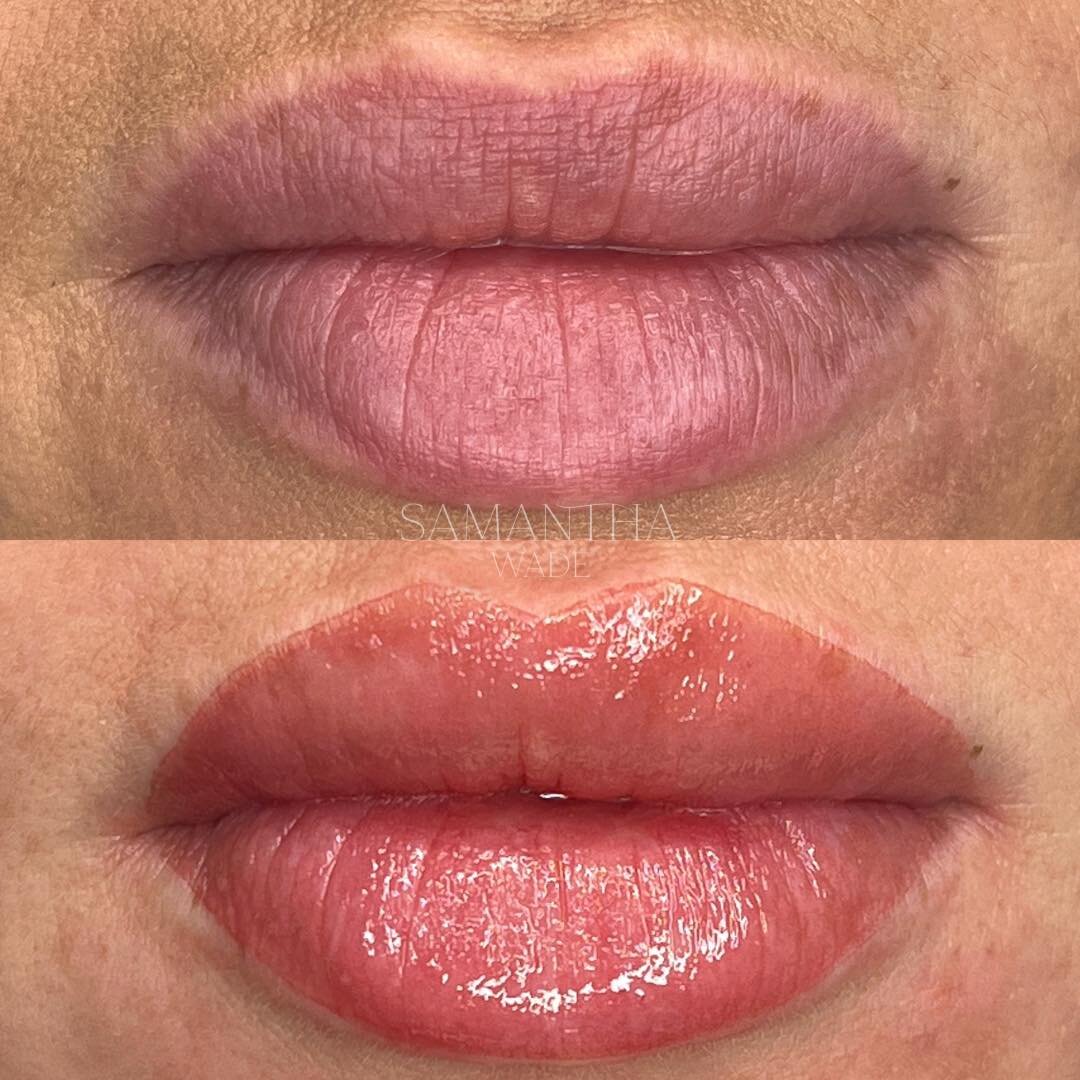 A little lip blush enhancement for you today. An already gorgeous shape that just needed a little tweaking and a wash of colour for some definition without an obvious lipstick look. This is exactly what lip blush is perfect for 🥰

#cosmetic #jersey 