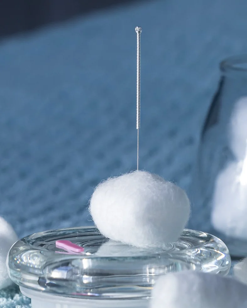 An acupuncture needle is seen sticking out of a cotton ball. We offer acupuncture therapy at Bruce Village Chiropractic. We may offer acupuncture as a standalone treatment or integrated therapy. We offer care to Port Elgin, Saugeen Shores.