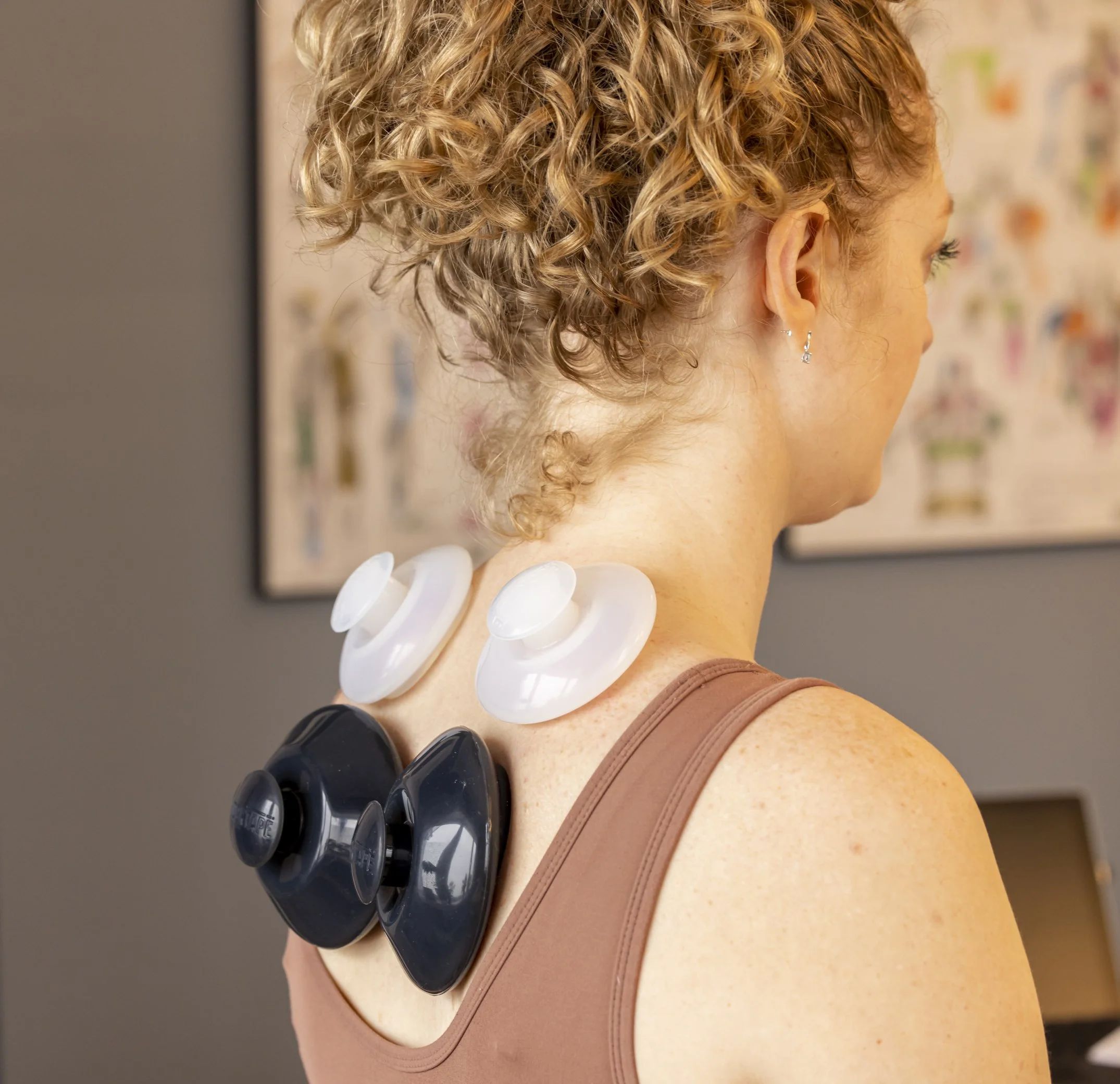 Cupping, silicone cupping, Bruce Village Chiropractic