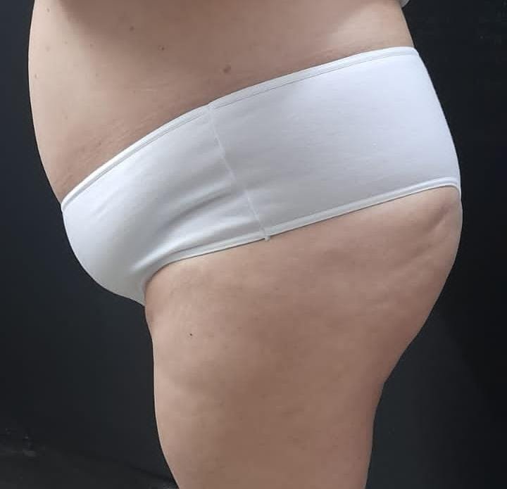 GORDIS 2.jpg