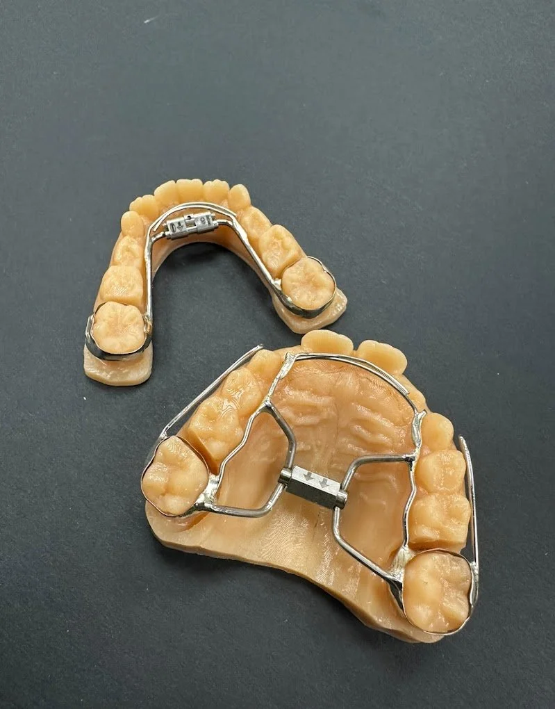 Ortho Lab Rx Services | Custom Solutions Await at DL Orthodontic Lab — dlortholab