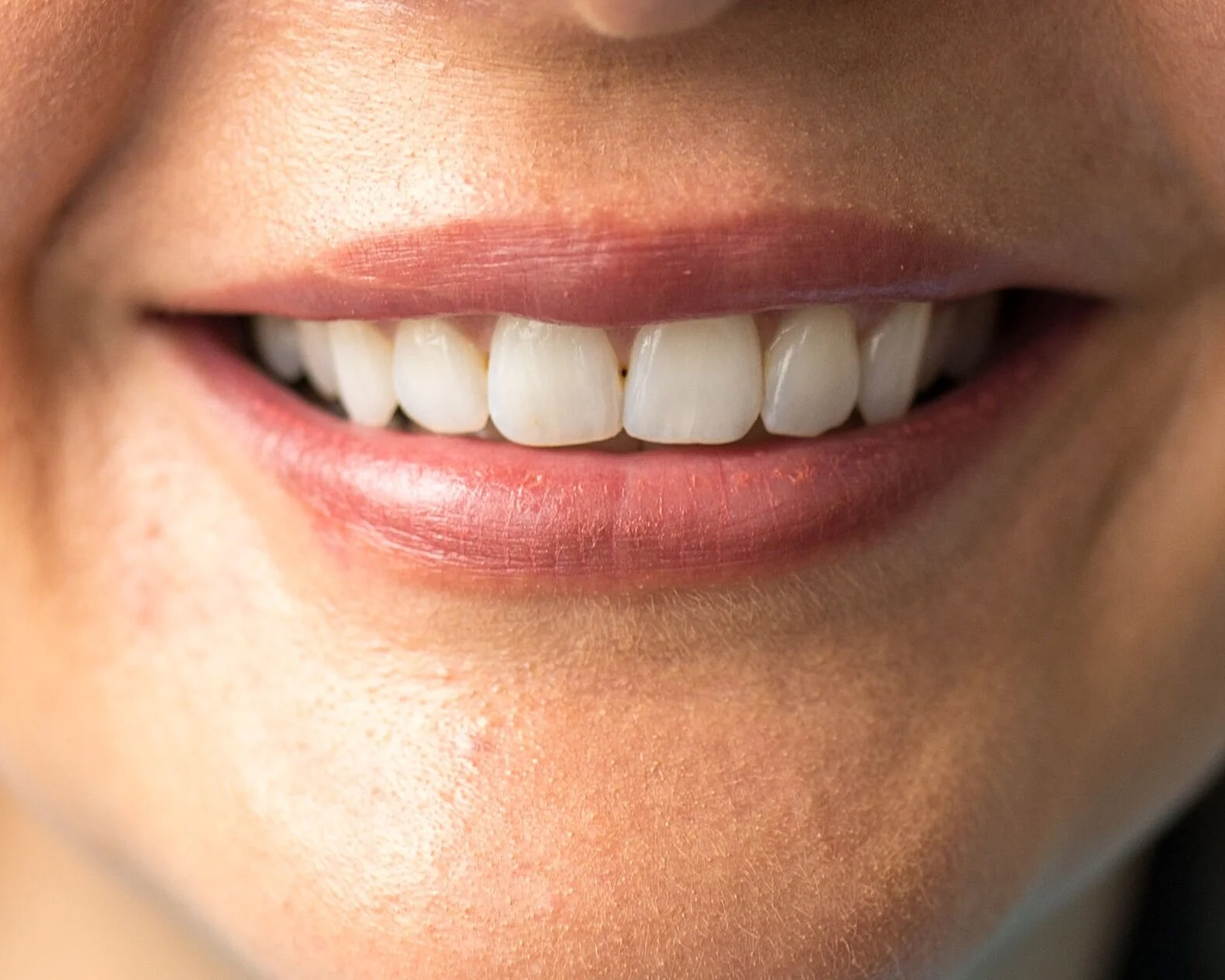 Woodhill Dental Care Cosmetic dentistry, teeth whitening, dental