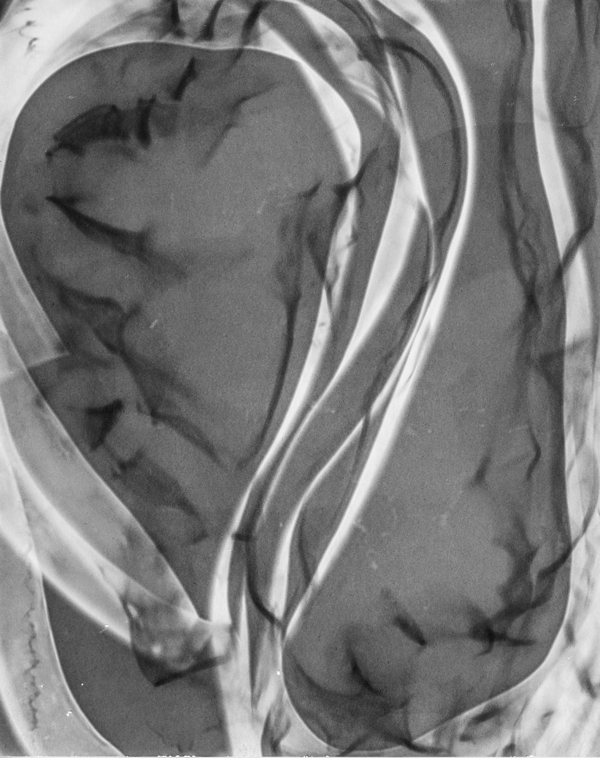 003_GhostlyTracesI_GelatinSilverPrintPhotogram_Fijalkovich.jpg
