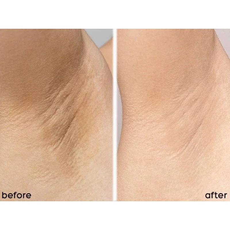 Angel's Liquid Glutathione+ Niacinamide Arbutin Cooling Fresh Deodorant —  jubbibeauty.com