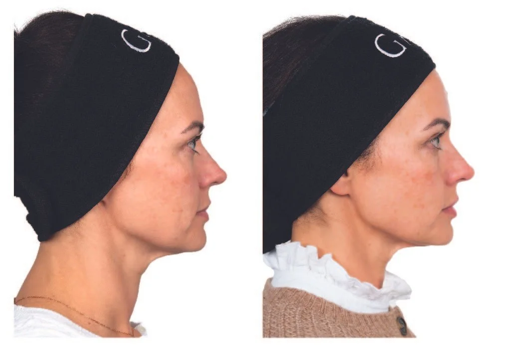 B+A EYELID_31.3.25 4-04.jpg