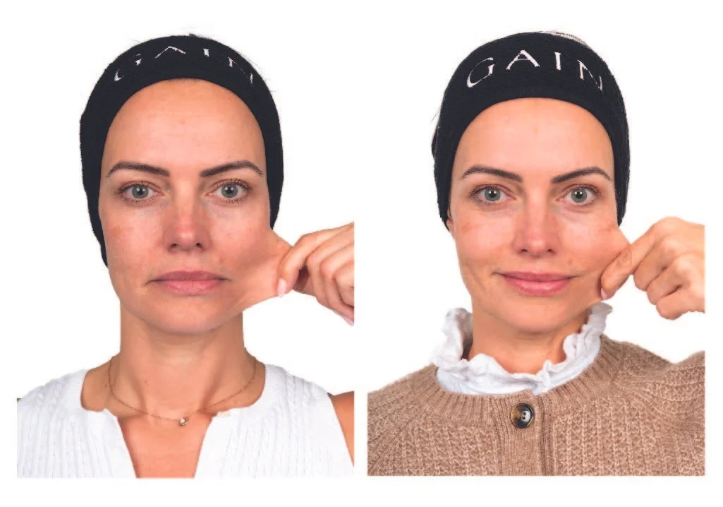 B+A EYELID_31.3.25 4-03.jpg