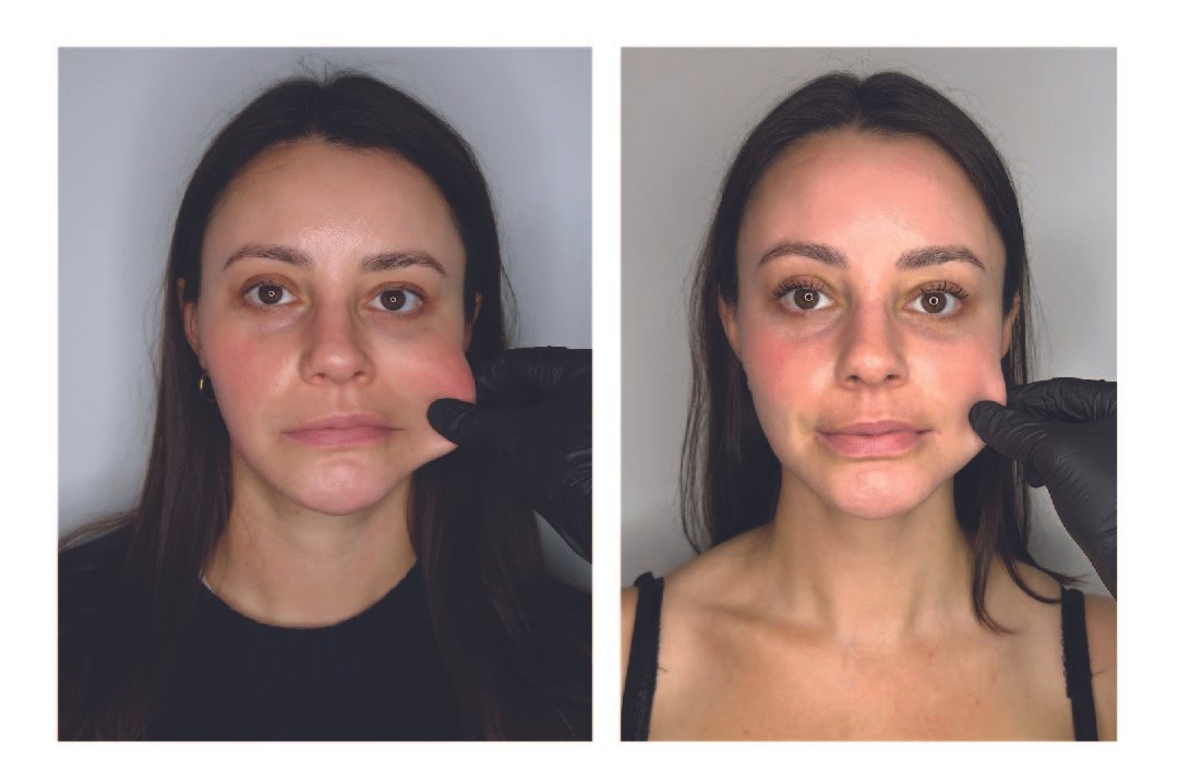 B+A SCULPTRA_10.8.2025.jpg