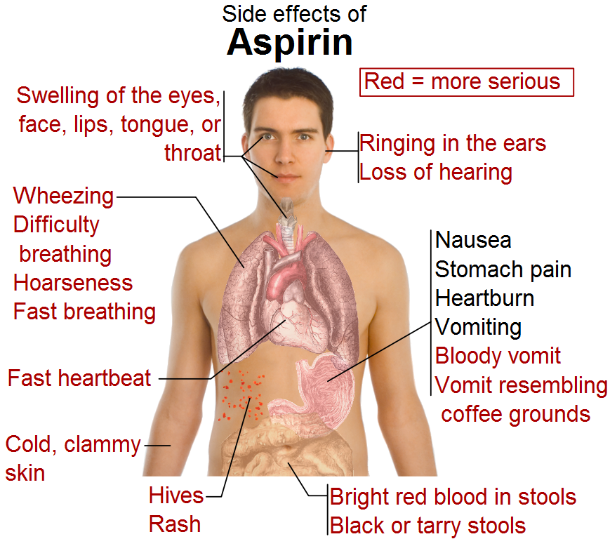 Side_effects_of_aspirin.png