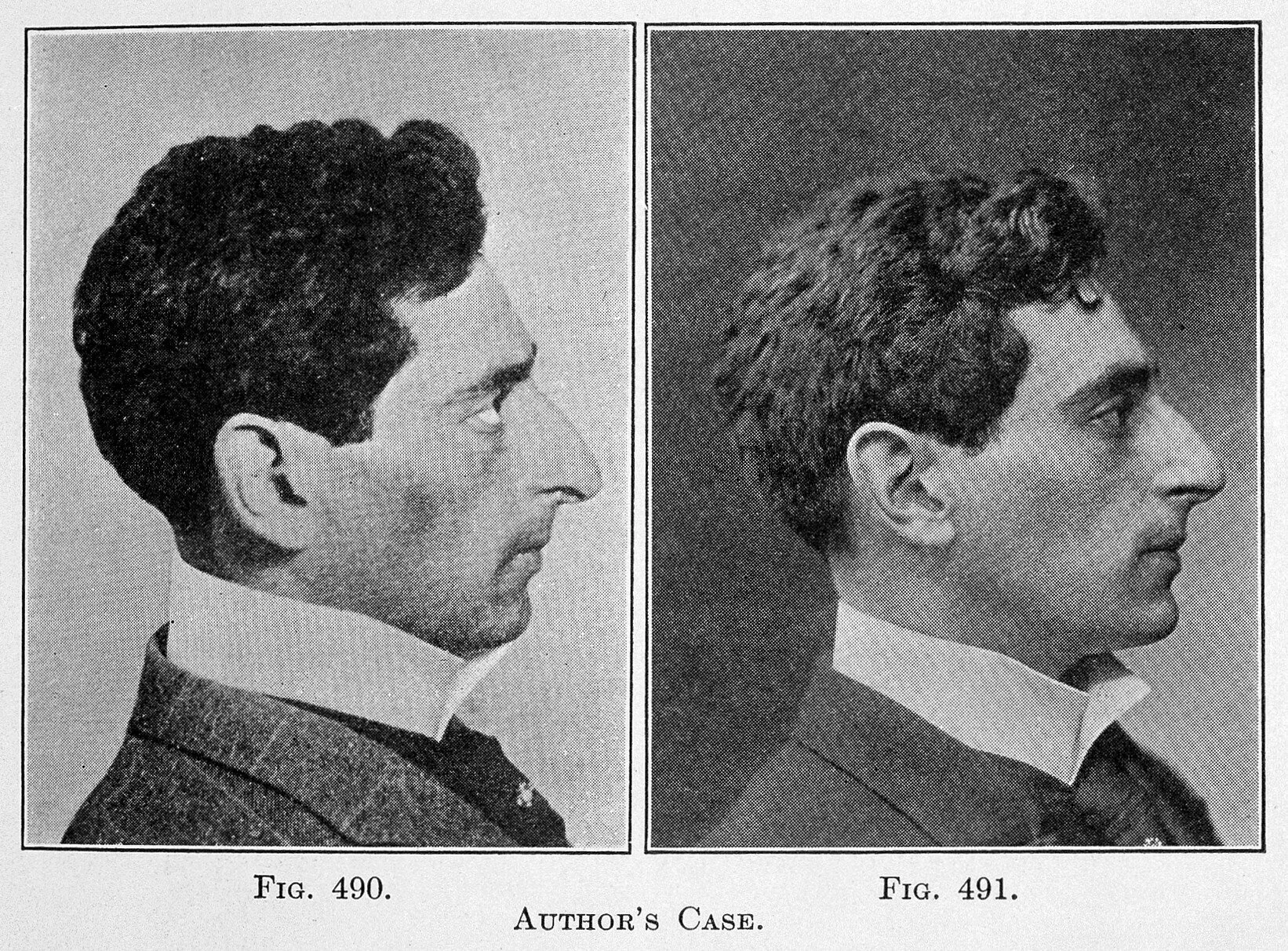 About Face