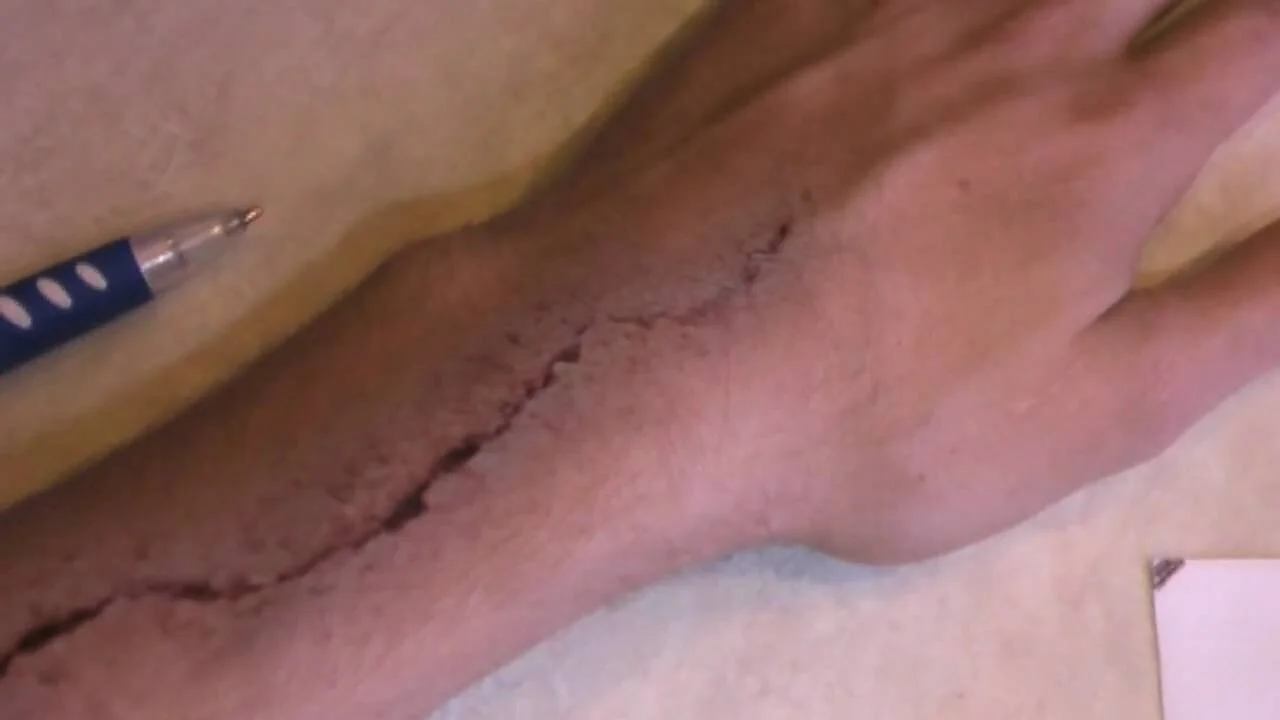 Complete Cellular Regeneration