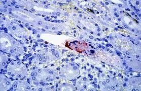 Plant Mutation: Disease Symbosis