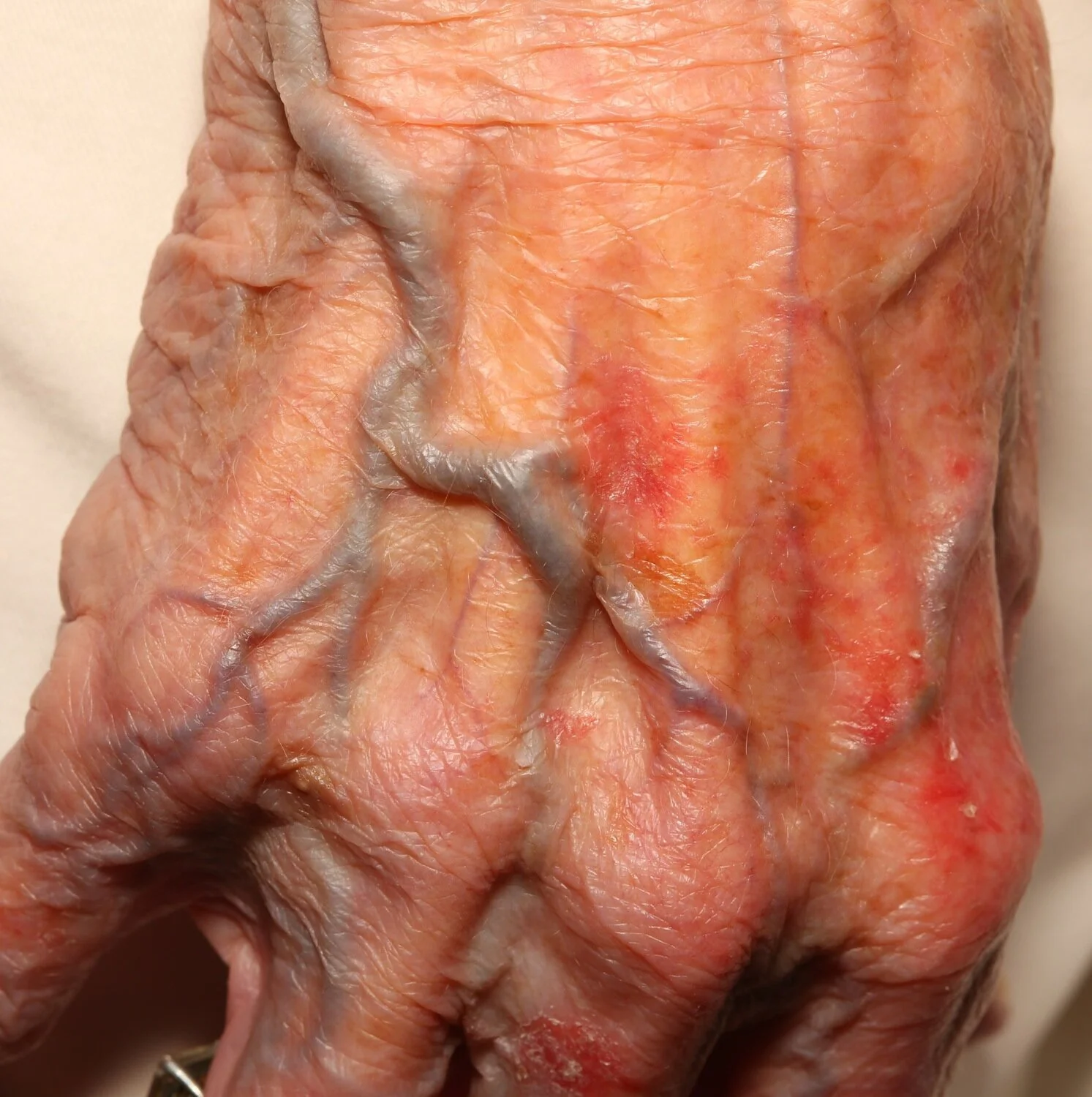 Ability Reduction - Temporary (Drawback) Physical Mutation