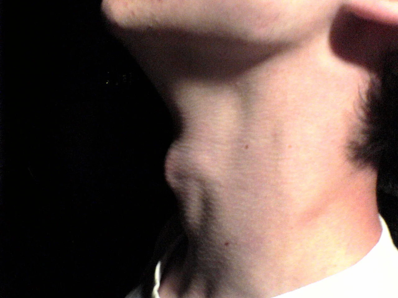 Physical Mutation Drawback: Damaged Vocal Cords