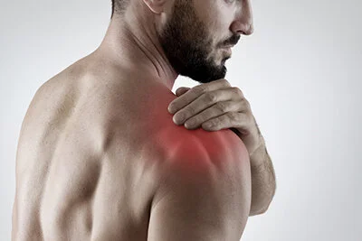 Encompassing 4 joints, shoulder complaints require careful orthopaedic assessment to determine the injured joint and associated soft tissue muscles, ligaments and tendons. Referred pain from the cervical and thoracic spine and ribs may also be present. Common causes of shoulder pain include tendonitis, rotator cuff tears, shoulder impingement syndrome, frozen shoulder, instability and bursitis. Suitable treatment includes joint mobilisation and/or manipulation, soft tissue therapy, dry needling, strapping, tailored exercise and strengthening protocols.