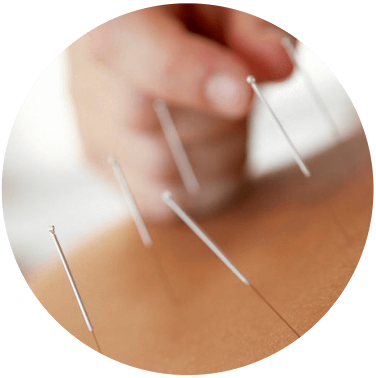 Musculoskeletal Acupuncture