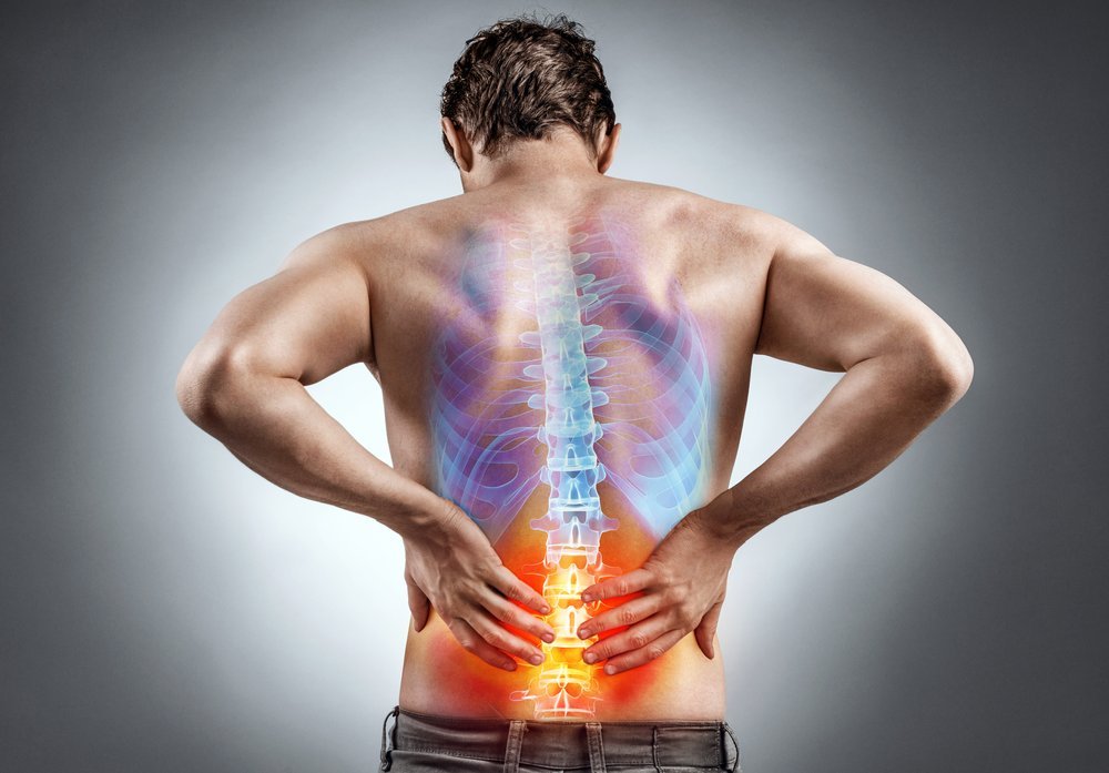 Sciatica, Lower Back Pain & the Sciatic Nerve
