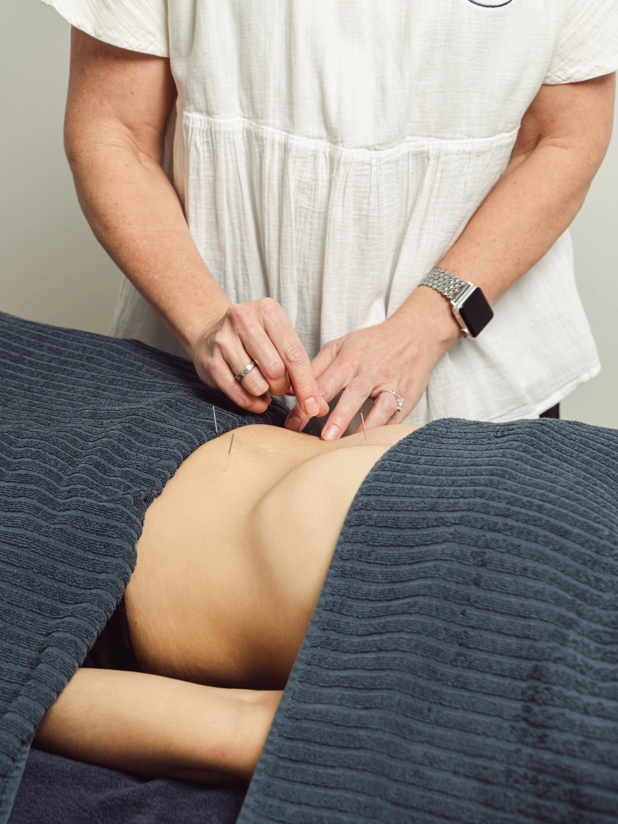 At Glow Health Co, we believe you deserve support through every stage of your pregnancy journey. Acupuncture and Traditional Chinese Medicine (TCM), provide a gentle, complementary approach that may help support your wellbeing during pregnancy.

So, 
