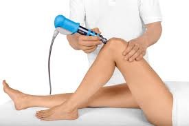 Shockwave Therapy in Leaside
