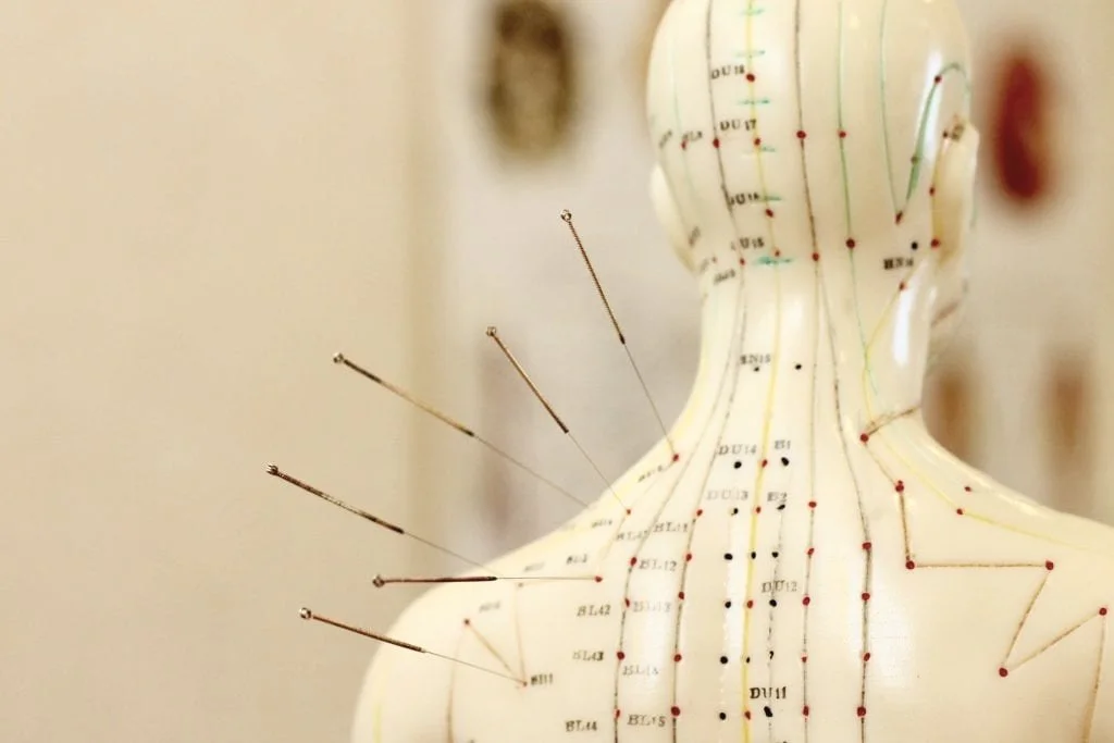An acupuncture model of the human back with acupuncture needles inserted.