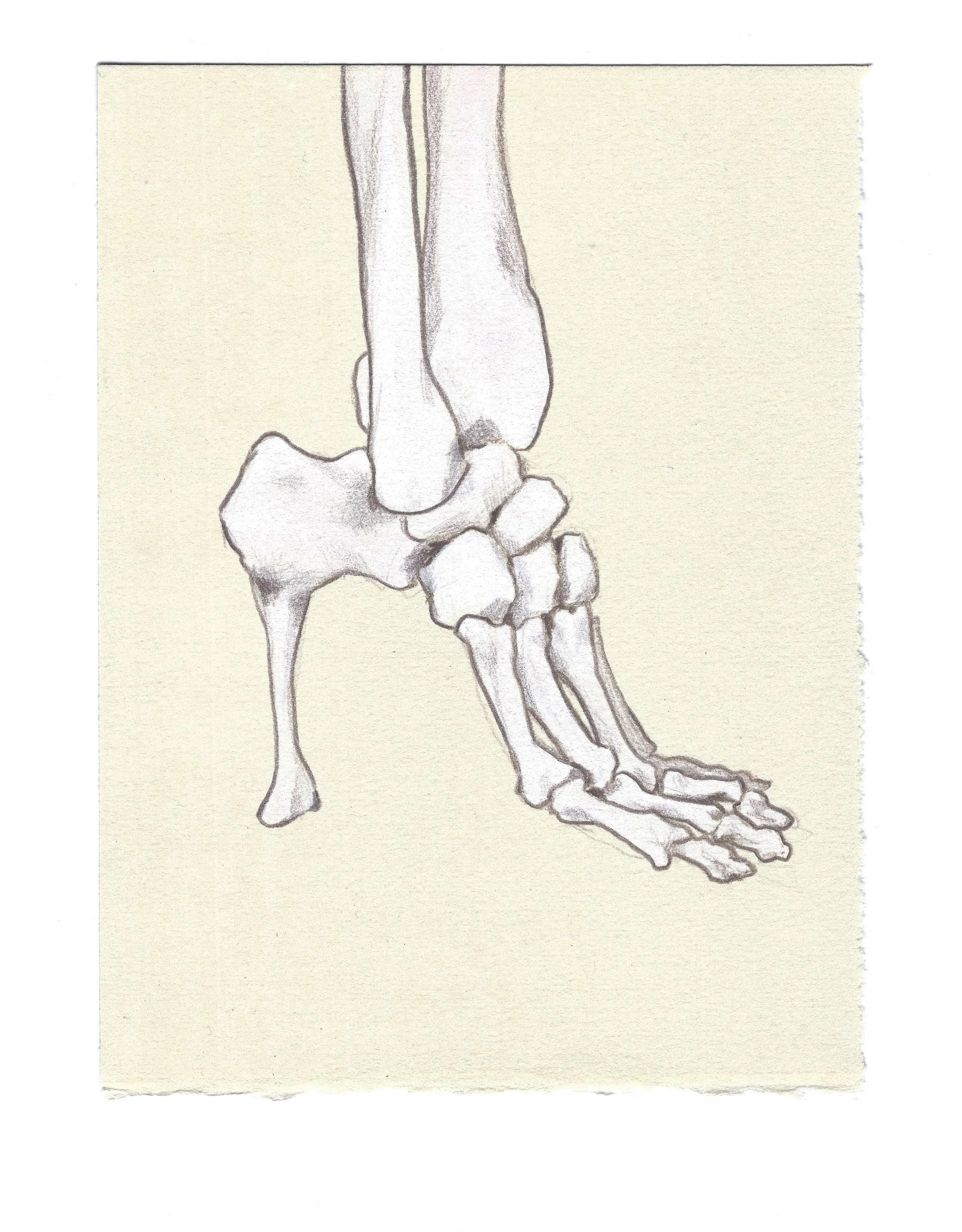 Calcanear Protrusion