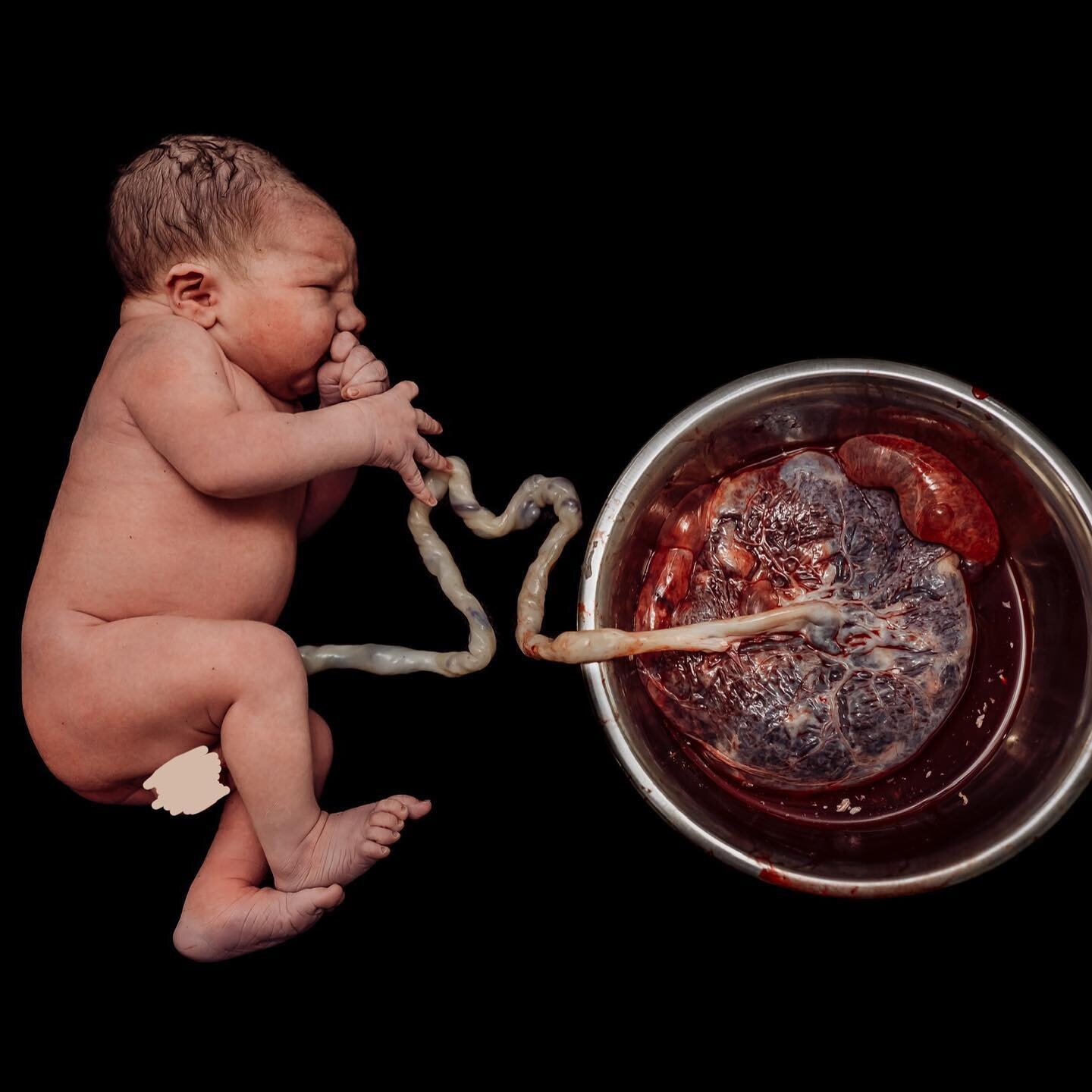 Another beautiful babe and his amazing placenta! ✨✨✨

#sunshinecoastbirthphotographer #sunshinecoastbirthphotography #sunshinecoastbaby #sunshinecoastnewborns #sunshinecoastphotographer #sunshinecoastmumsandbubs #birthphotography #birthphotographer #