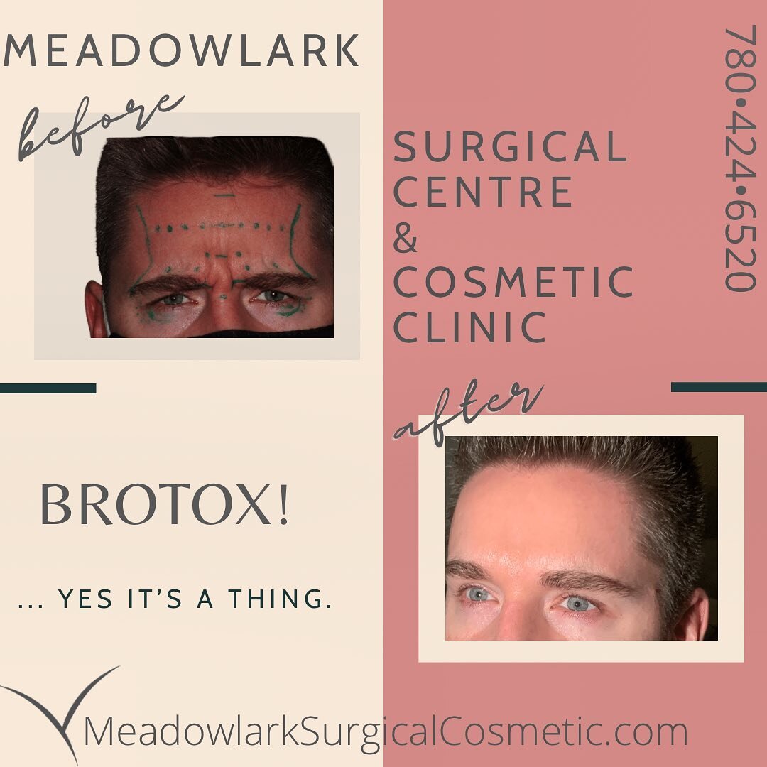 BROTOX ... YES it&rsquo;s a thing! 🙌🏼
Injections are not just for women... they&rsquo;re for Bros too! Meet Meadowlark Surgical Centre &amp; Cosmetic Clinic&rsquo;s Registered Nurse and BROTOX specialist: Kevin Kokotilo 
&bull;PTIFA Level 2 Certifi