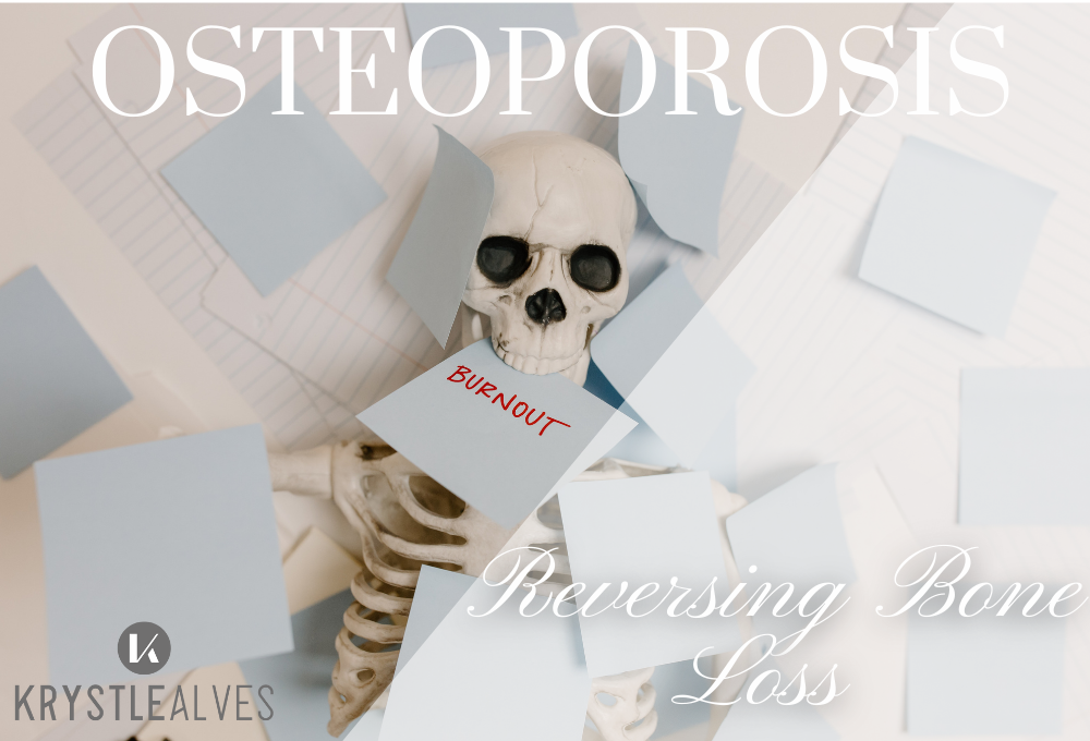 Preventing Osteoporosis - What You Need To Know