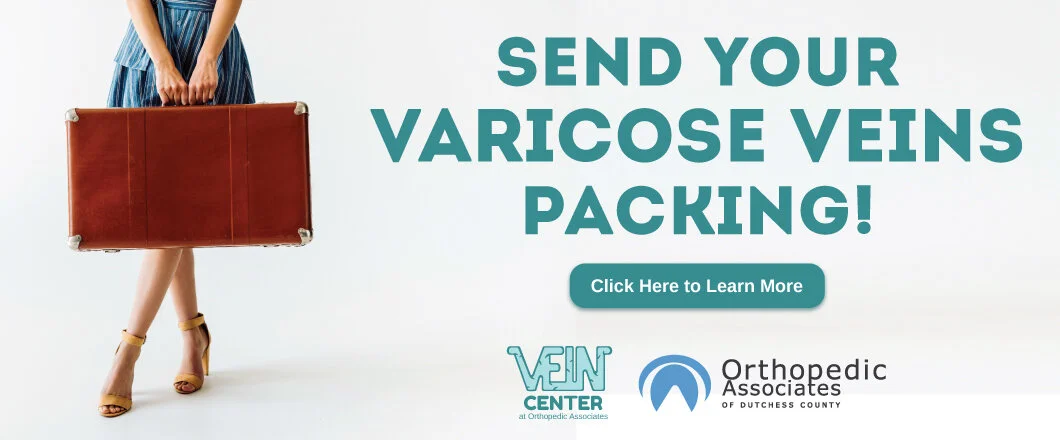 Varicose-Vein-Web-Banner.jpg