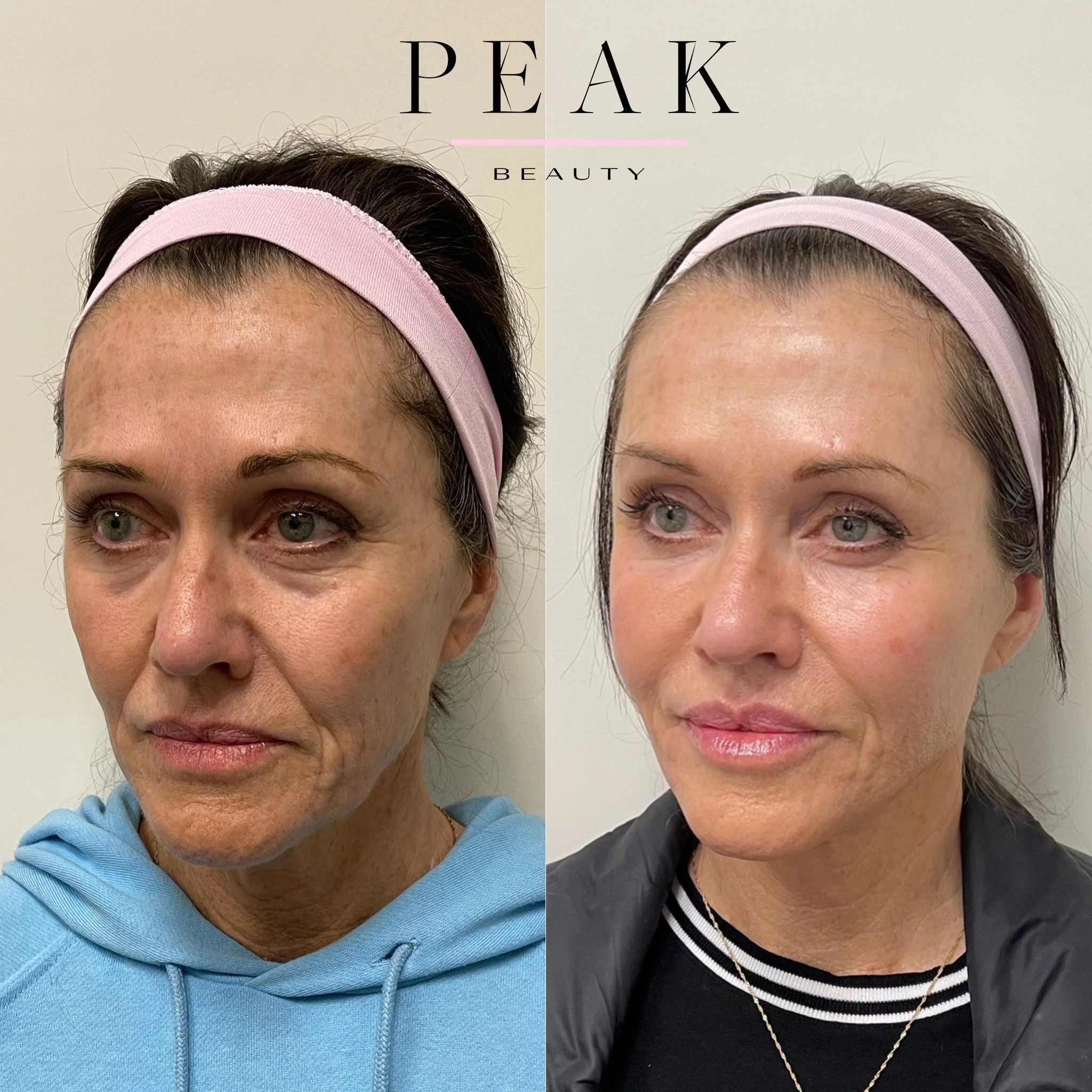 12960410-68E0-43F8-AF2A-C7496111CAA6 3.jpeg