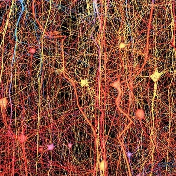 Close-up of colorful neural network or nerve cells with intertwined, branching structures.